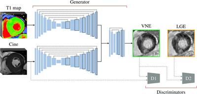 Quality control-driven deep ensemble for accountable automated segmentation of cardiac magnetic resonance LGE and VNE images